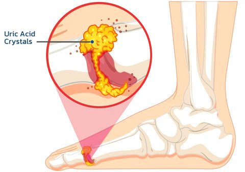 Osteoarthritis Advancaed Joint Therapy Cream