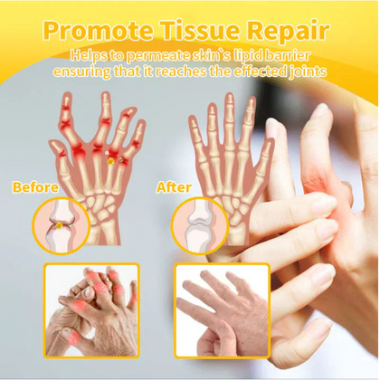 Osteoarthritis Advancaed Joint Therapy Cream