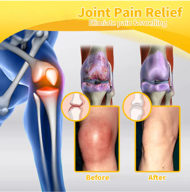 Osteoarthritis Advancaed Joint Therapy Cream