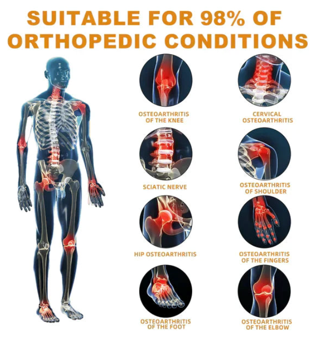 Osteoarthritis Advancaed Joint Therapy Cream